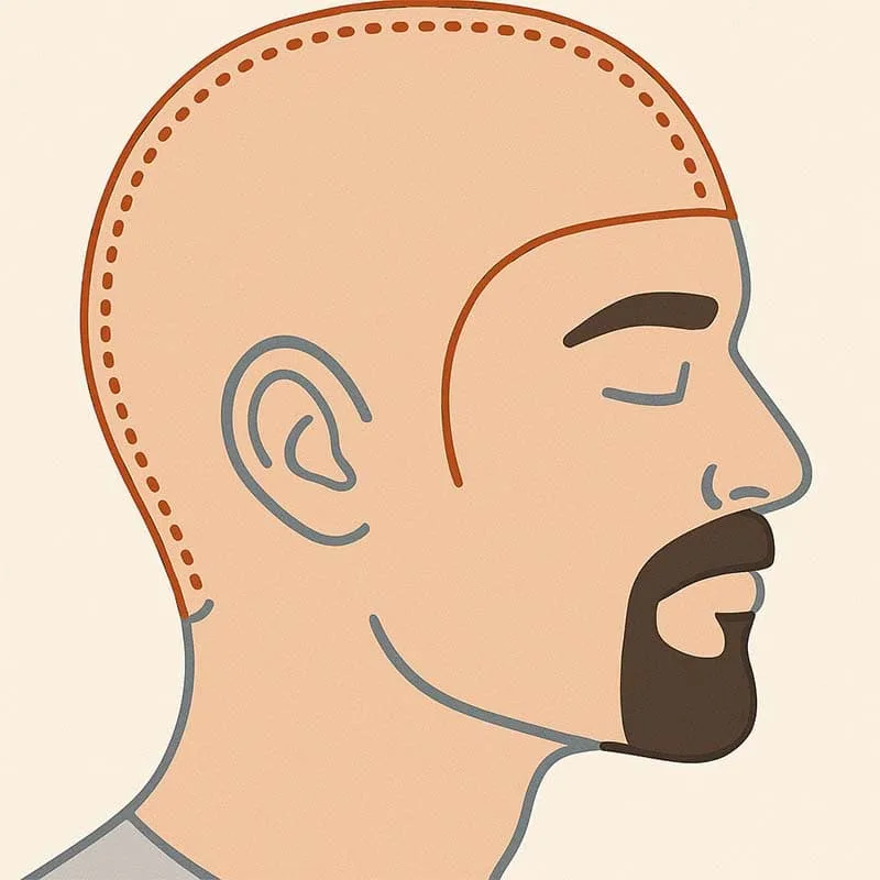 full head laser hair removal