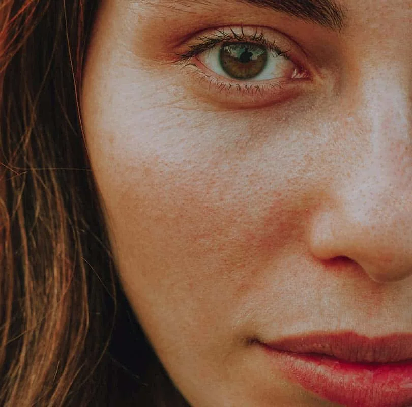 Upper Lip Treatment