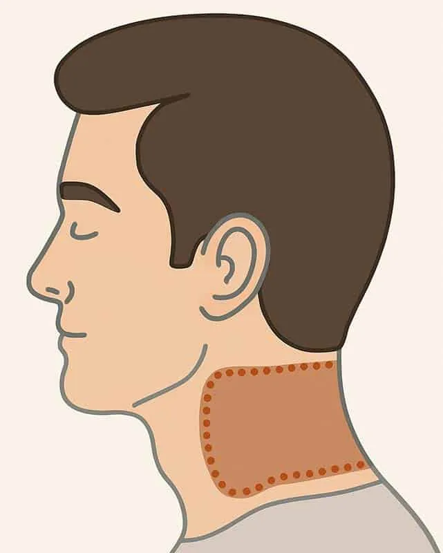neck laser hair removal